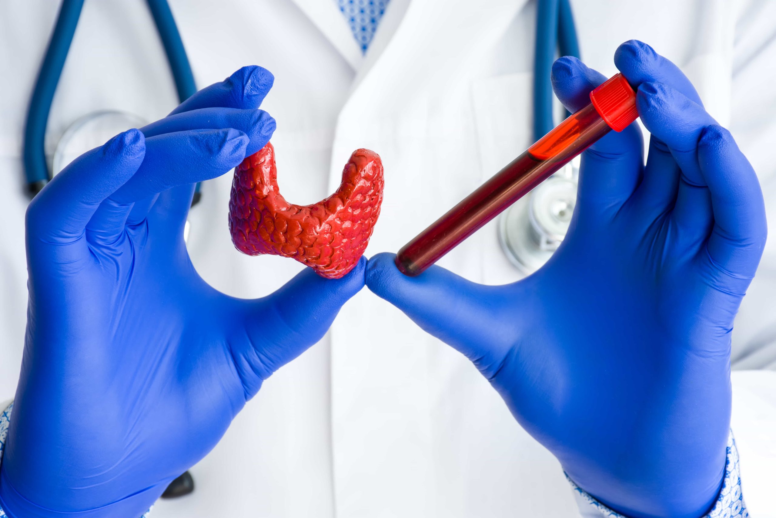 THYROID FUNCTION TEST
