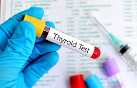 THYROID FUNCTION TEST