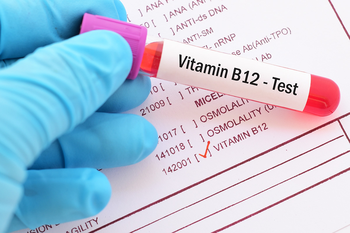 VITAMIN B12 TEST
