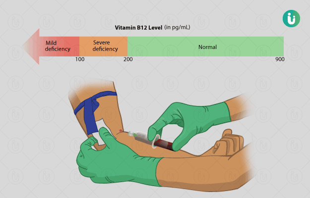 VITAMIN B12 TEST