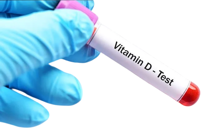 VITAMIN D3 TEST