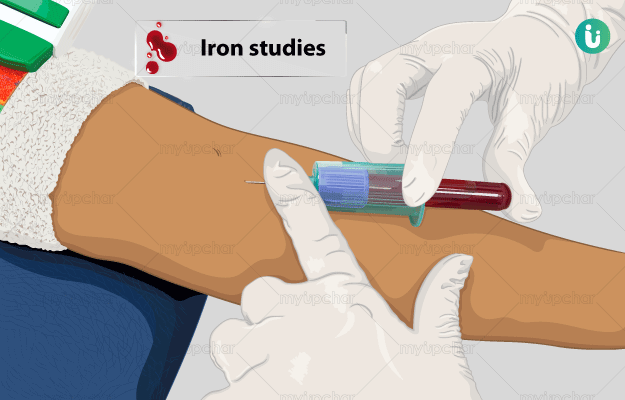 IRON STUDIES TEST