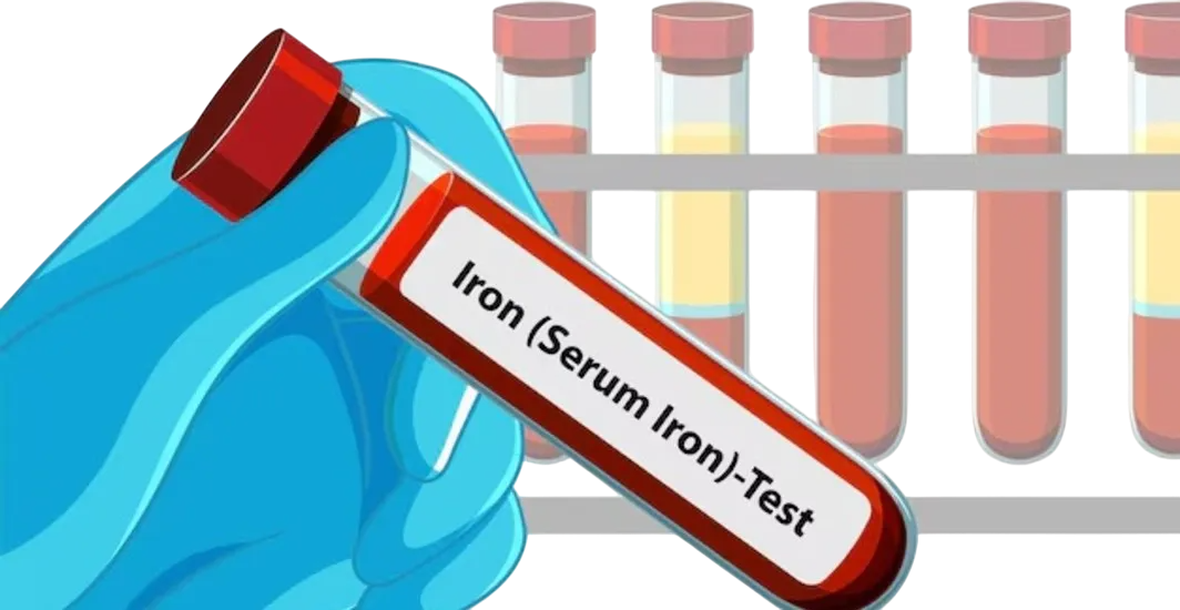 IRON STUDIES TEST
