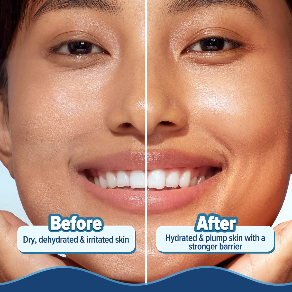 AQUALOGICA BARRIER + HYDRA GEL MOISTURIZER WITH 5 CERAMIDES & AVOCADO 200GM