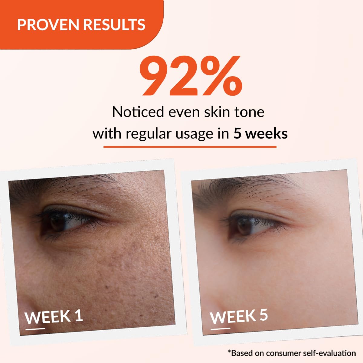 FIXDERMA TRANEXAMIC ACID + 2% KOJIC ACID + 1% ARBUTIN SKARFIX -TX FACE CREAM 30GM