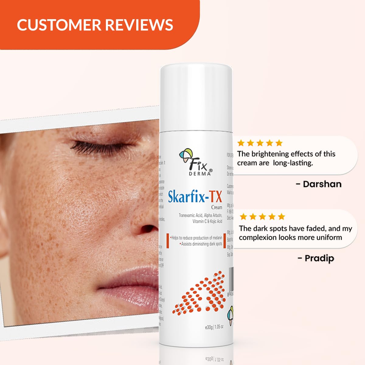 FIXDERMA TRANEXAMIC ACID + 2% KOJIC ACID + 1% ARBUTIN SKARFIX -TX FACE CREAM 30GM