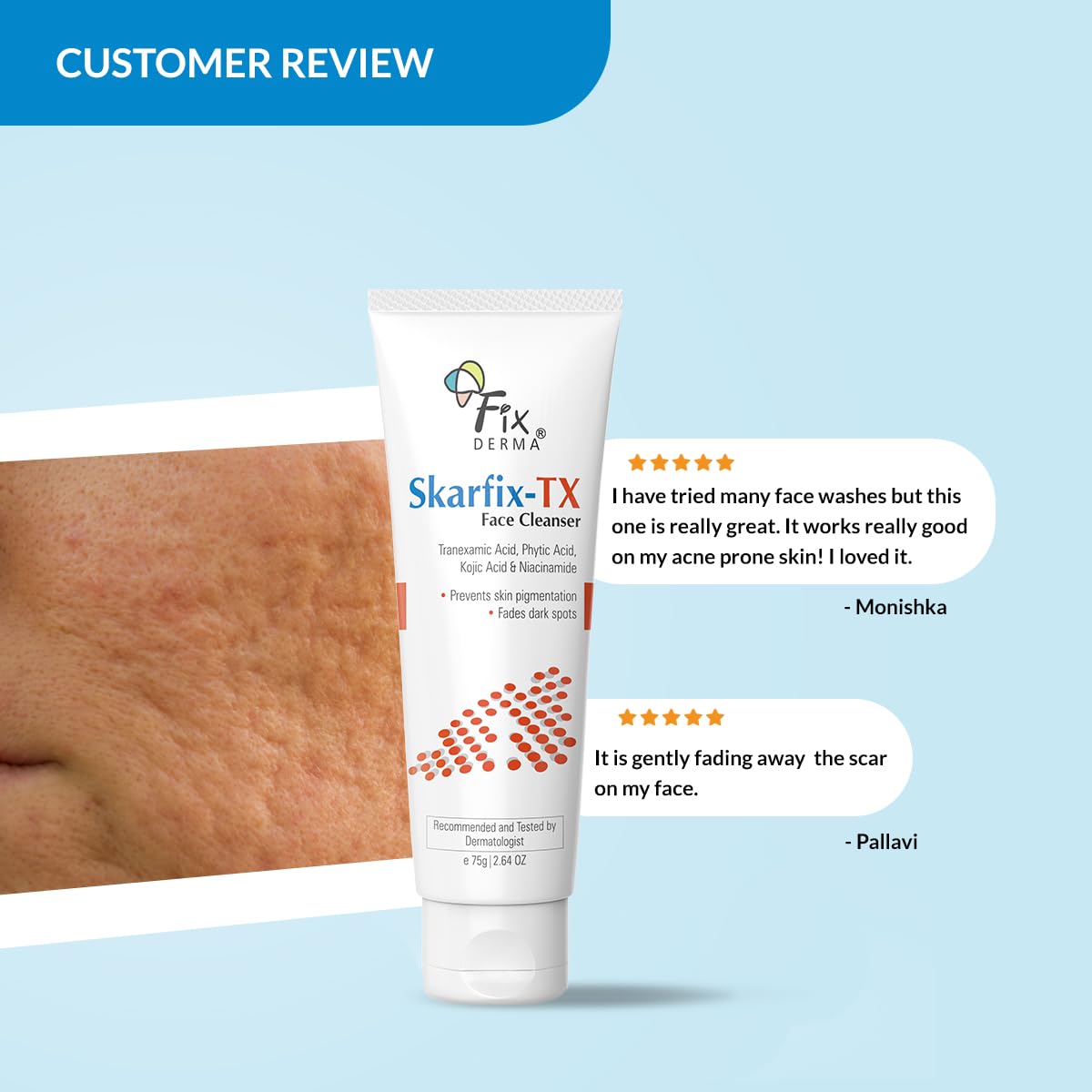 FIXDERMA SKARFIX -TX FACE CLEANSER WITH TRANEXAMIC ACID, KOJIC ACID & NIACINAMIDE 75GM