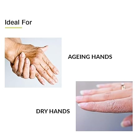 FIXDERMA ANTI AGEING HAND CREAM FOR WOMEN & MEN FOR DRY AND ROUGH HANDS 30GM