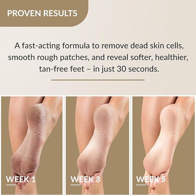 FIXDERMA FOOBETIK FOOT SCRUB SPRAY WITH LACTIC ACID 30 SEC FOOT FACIAL SPRAY 50ML