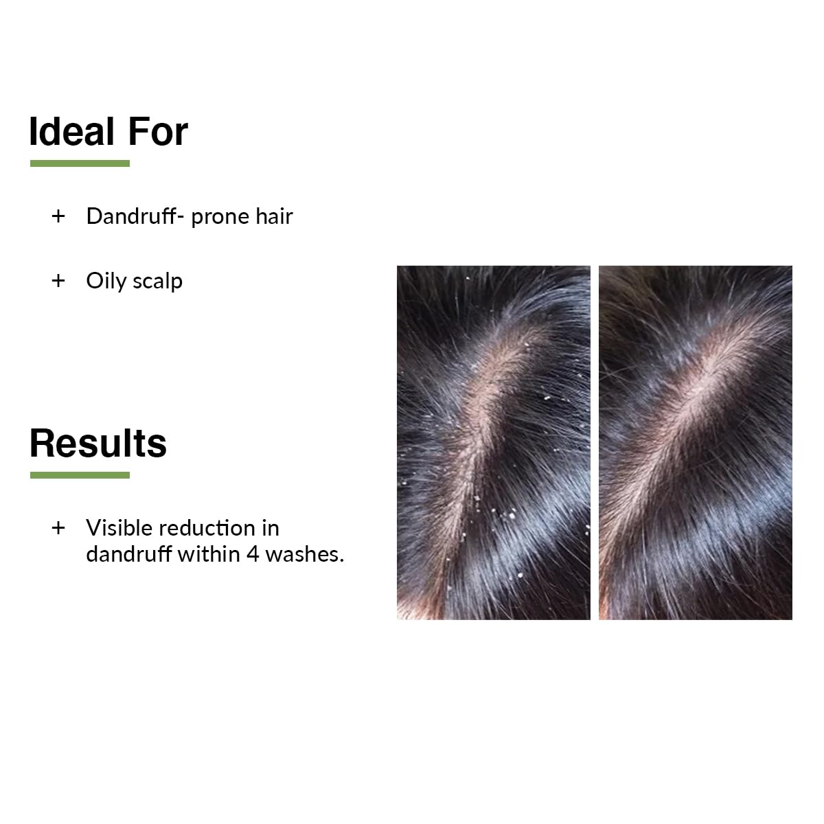 FIXDERMA KAIRFOLL ANTI DANDRUFF SHAMPOO RELIEVES SCALP IRRITATION FROM THE FIRST WASH 100ML