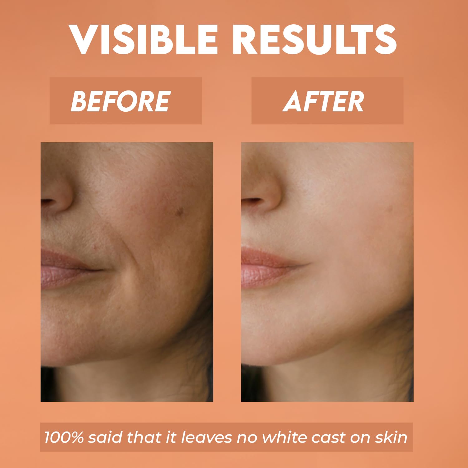 JOVEES HERBAL SUN AQUA GEL SPF50 PA+++ | LIGHTWEIGHT, WATER-LIKE TEXTURE OILY & COMBINATION SKIN100G