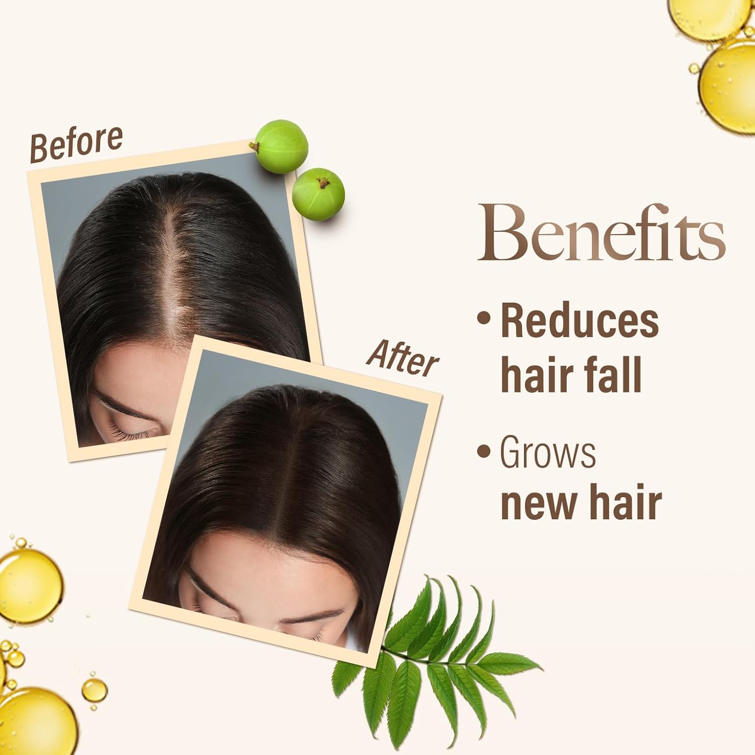 KESH KING AYURVEDIC SCALP AND HAIR OIL, 100ML